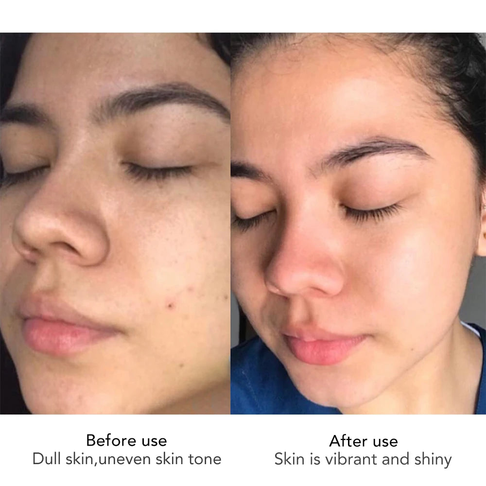 AILKE Face Cream With Hyaluron Scars Whitening Moisturizing Lifting Anti-aging Women Sleeping Dry Korean Bleaching Skin Care